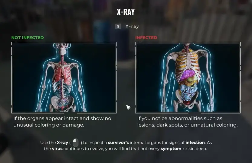 Miami Zero X-Ray tutorial comparing intact internal organs with abnormalities found in an infected survivor